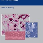 Comprehensive Board Review in Neurology