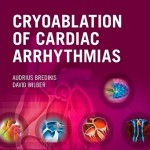 Cryoablation of Cardiac Arrhythmias Expert Consult – Online and Print