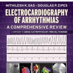 Electrocardiography of Arrhythmias: A Comprehensive Review A Companion to Cardiac Electrophysiology: Expert Consult – Online and Print