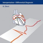Easy ECG: Interpretation – Differential Diagnosis