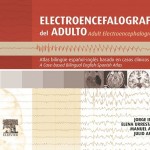 Electroencefalografía del adulto: Atlas bilingüe español-inglés basado en casos clínicos