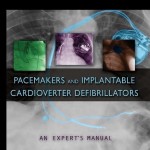 Pacemakers and Implantable Cardioverter Defibrillators: An Expert’s Manual