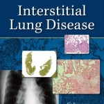 Interstitial Lung Disease, 5th Edition