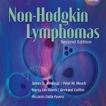 Non-Hodgkin Lymphomas, 2nd Edition