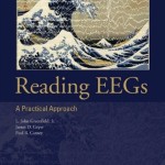 Reading EEGs: A Practical Approach