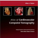 Atlas of Cardiovascular Computed Tomography: Expert Consult – Online and Print Imaging Companion to Braunwald’s Heart Disease