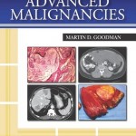 Regional Therapeutics for Advanced Malignancies