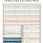 Handbook of ICU EEG Monitoring