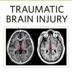 Traumatic Brain Injury