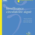 Insuffisance circulatoire aiguë