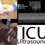 The ICU Ultrasound Pocket Book