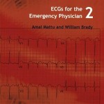 ECGs for the Emergency Physician 2