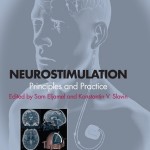 Neurostimulation: Principles and Practice