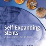 Self-Expanding Stents in Gastrointestinal Endoscopy