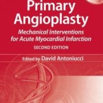 Primary Angioplasty: Mechanical Interventions for Acute Myocardial Infarction