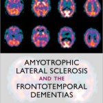Amyotrophic Lateral Sclerosis and the Frontotemporal Dementias