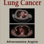 Lung Cancer