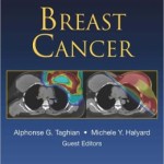 Breast Cancer: Radiation Medicine Rounds