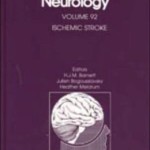 Ischemic Stroke