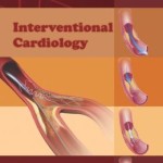 Interventional Cardiology – ECAB