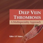Deep Vein Thrombosis – ECAB: –
