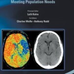 A Practical Guide to Comprehensive Stroke Care: Meeting Population Needs
