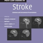 More Case Studies in Stroke: Common and Uncommon Presentations