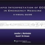 Rapid Interpretation of ECGs in Emergency Medicine: A Visual Guide