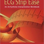ECG Strip Ease: An Arrhythmia Interpretation Workbook
                    
