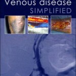 Venous Disease Simplified