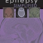 Epilepsy Simplified