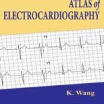 Atlas of Electrocardiography