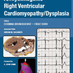 Current Concepts in Arrhythmogenic Right Ventricular Cardiomyopathy/Dysplasia