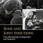 Bone and Joint Infections: From Microbiology to Diagnostics and Treatment