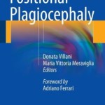 Positional Plagiocephaly
