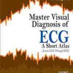 Master Visual Diagnosis of ECG