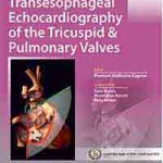 Transesophageal Echocardiography of the Tricuspid and Pulmonary Valves