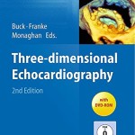 Three-dimensional Echocardiography, 2nd Edition