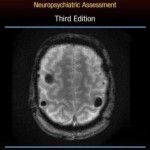 Traumatic Brain Injury: Methods for Clinical and Forensic Neuropsychiatric Assessment,Third Edition