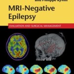 MRI-Negative Epilepsy: Evaluation and Surgical Management