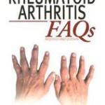 Rheumatoid Arthritis FAQs