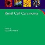 Renal Cell Carcinoma
