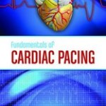 Fundamentals of Cardiac Pacing