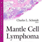 Mantle Cell Lymphoma: Clinical Characteristics, Prevalence and Treatment Options