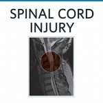 Spinal Cord Injury