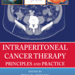Intraperitoneal Cancer Therapy: Principles and Practice