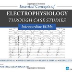 Essential Concepts of Electrophysiology through Case Studies: Intracardiac EGMs