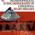 Transesophageal Echocardiography of Congenital Heart Diseases