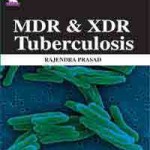 MDR & XDR Tuberculosis
