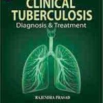 Clinical Tuberculosis: Diagnosis & Treatment